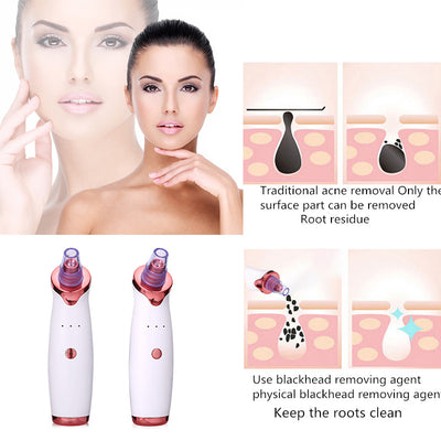 Beauty Skin Care Tool: Acne Face Vacuum Suction Cleaner