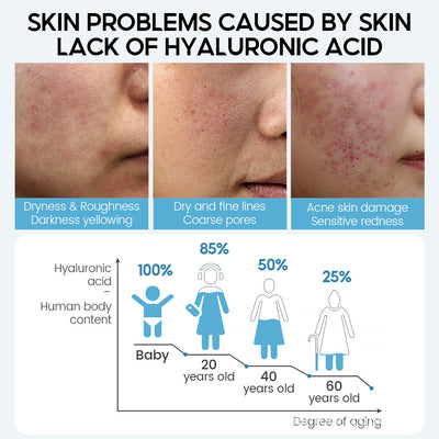 Hyaluronic acid benefits